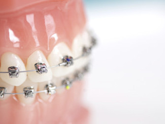 what-is-orthodontics.jpg